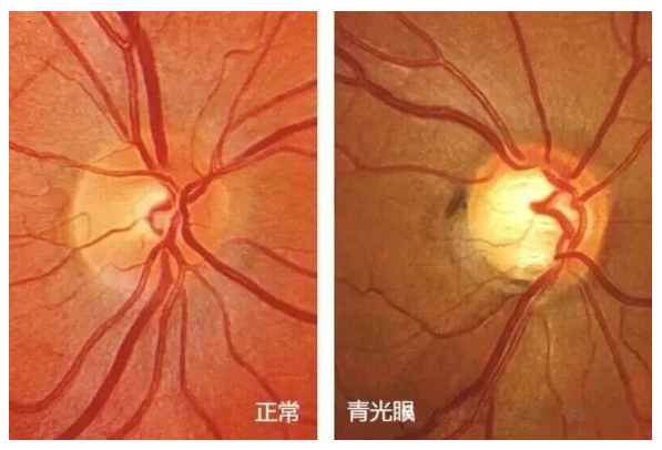 QQ20260129-095648.jpg