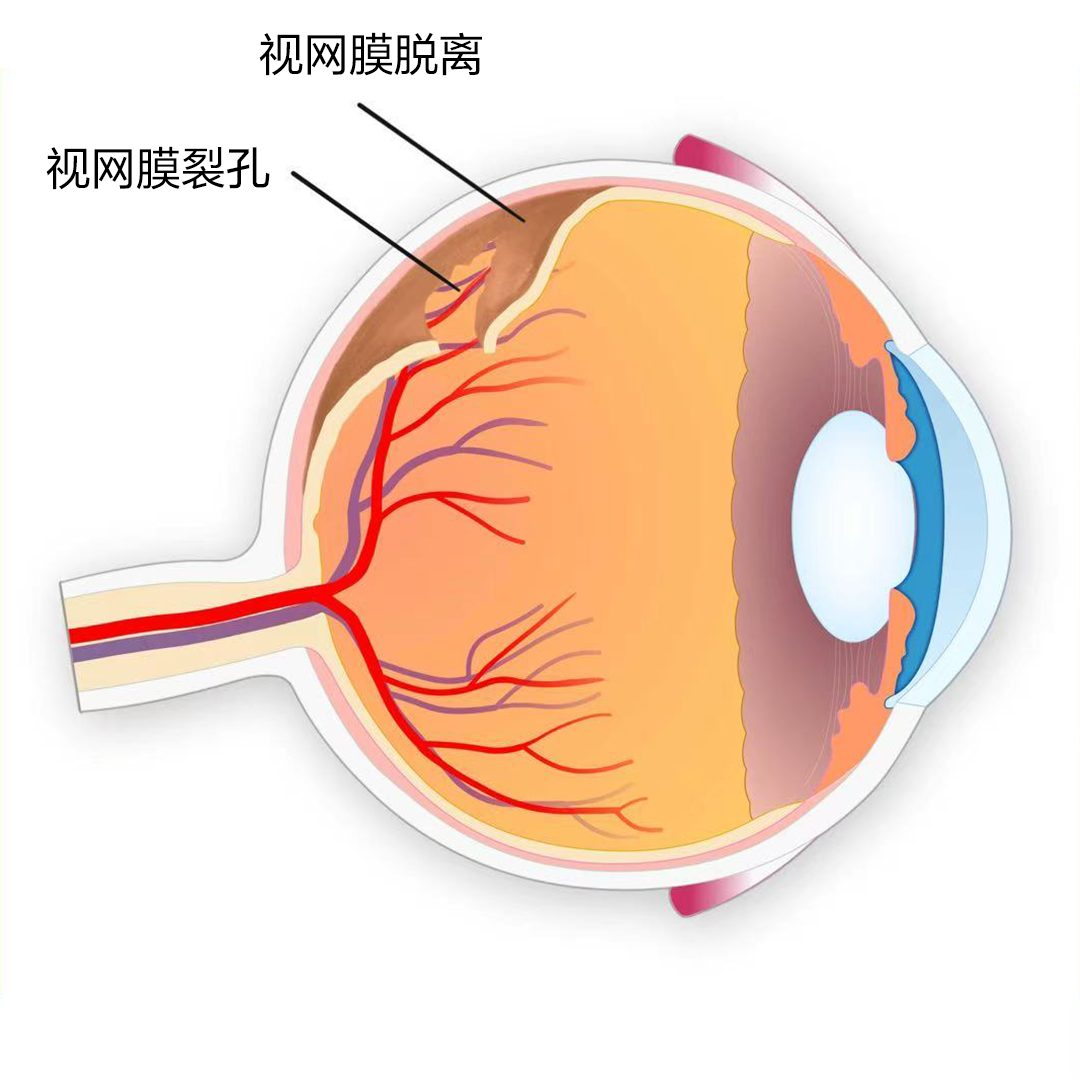 眼球结构