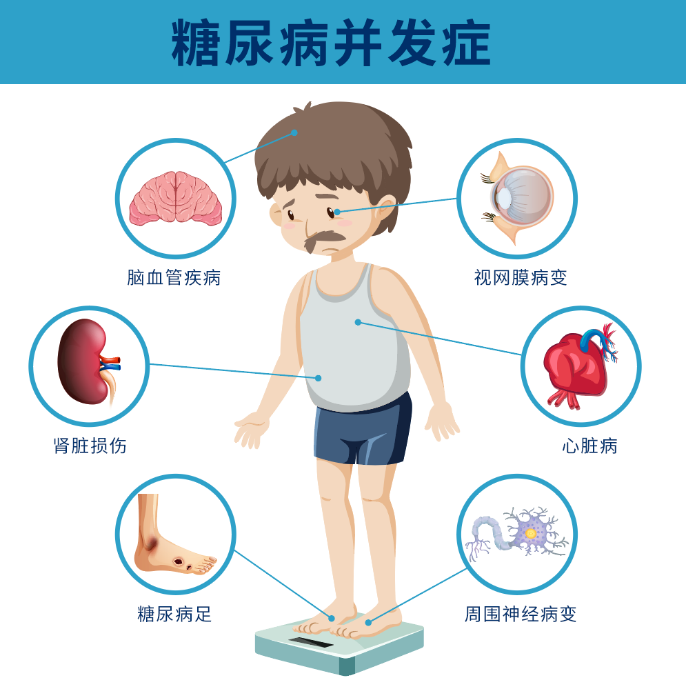 糖尿病并发症