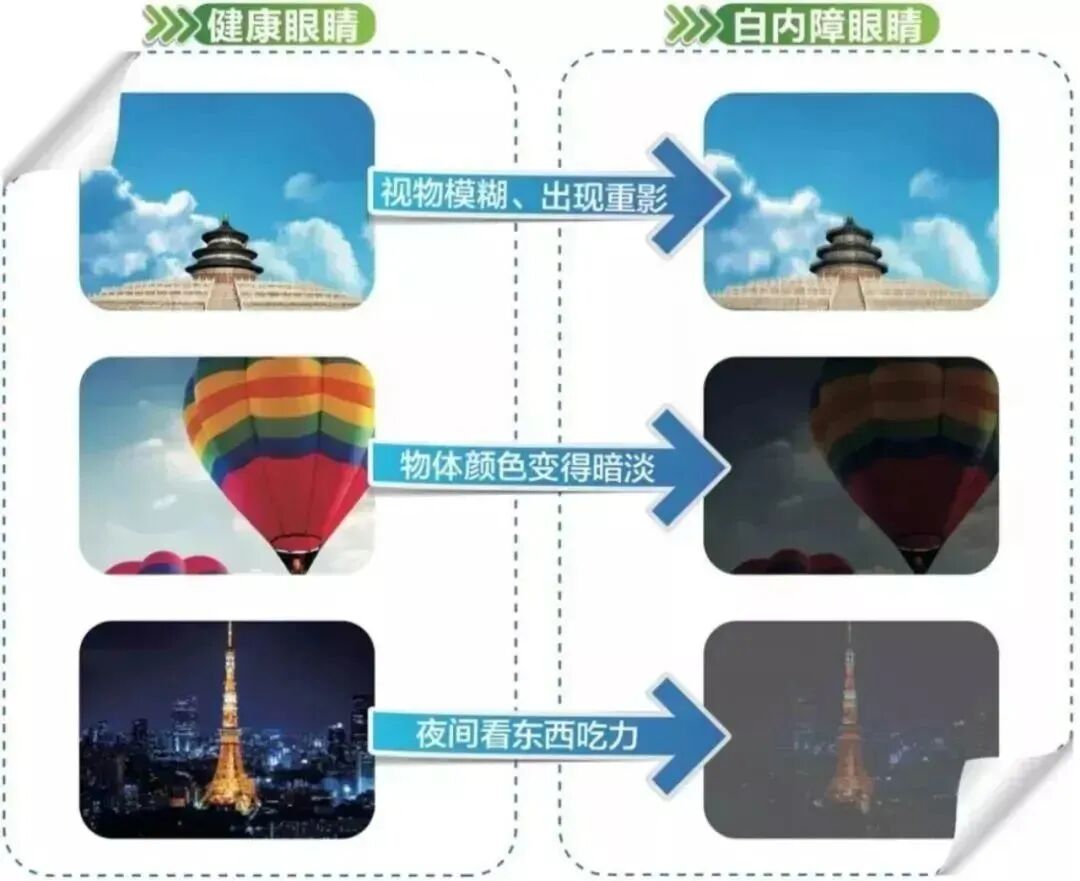 视物