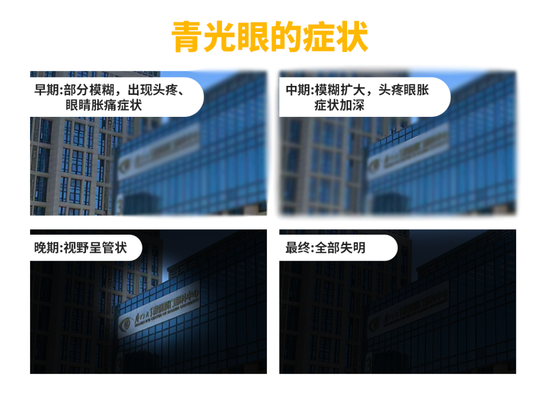 青光眼症状