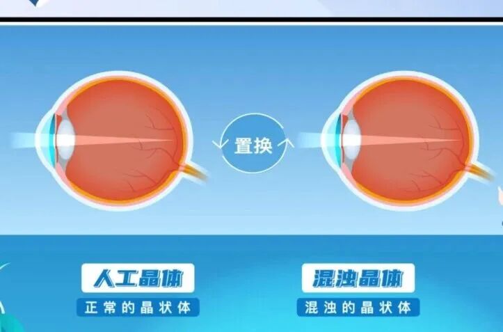 诊疗手段