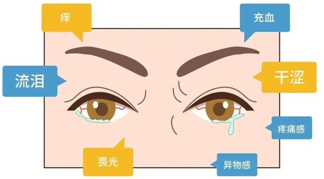 徐州复兴眼科|秋风一吹，眼睛秒变“沙漠皮”？这份自救指南快收好丨干眼症