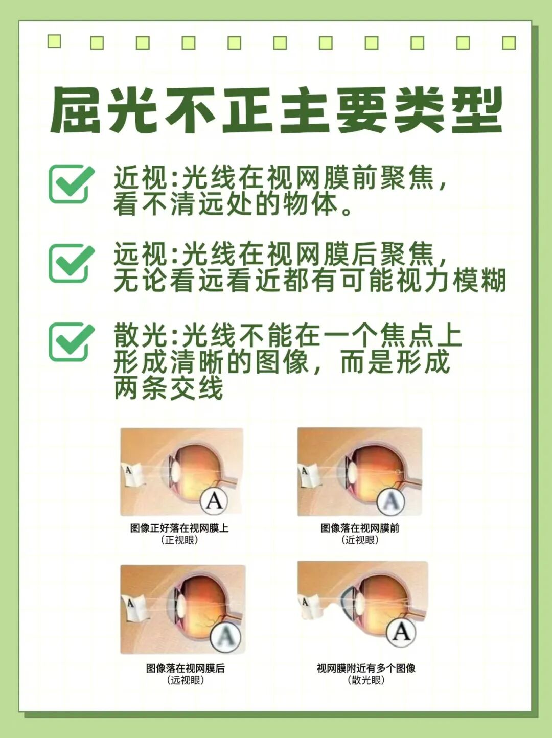 屈光不正主要类型