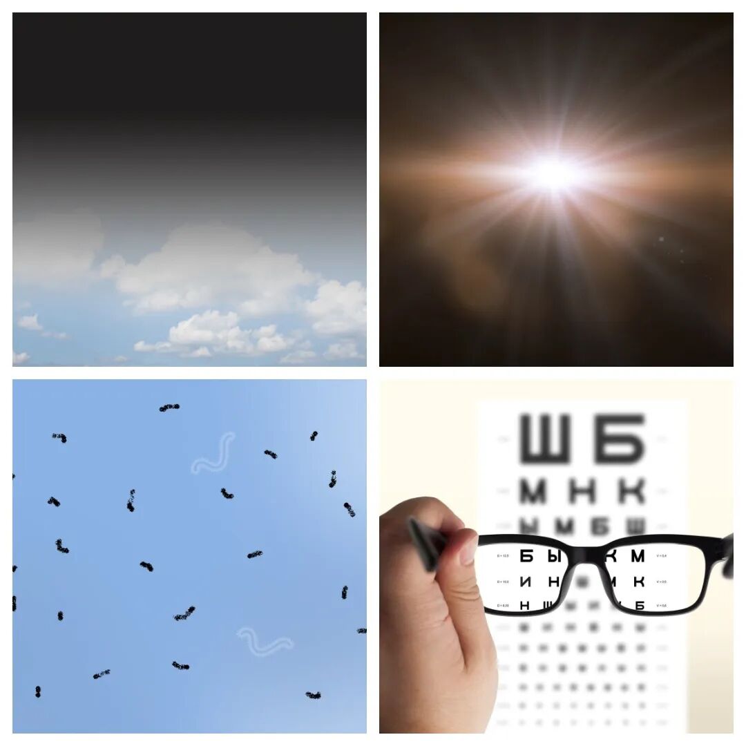 视网膜脱离典型症状