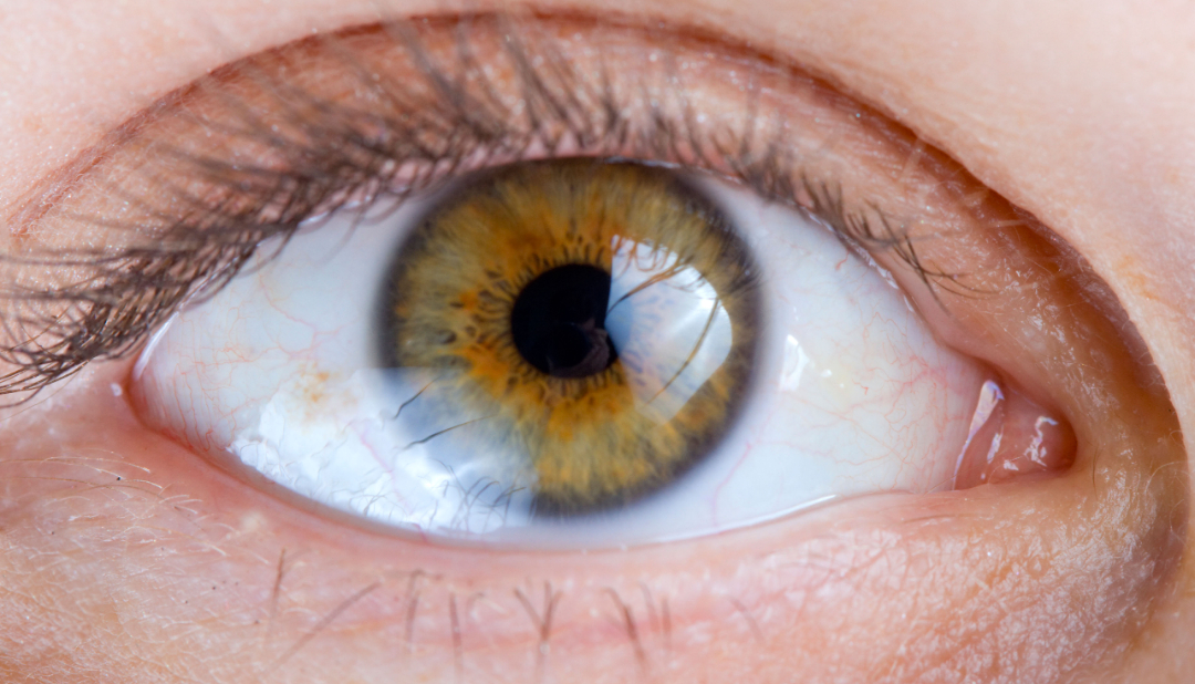 合肥华厦名人眼科 | 眼睛干痒怎么办？大多数人不知道要这样做....