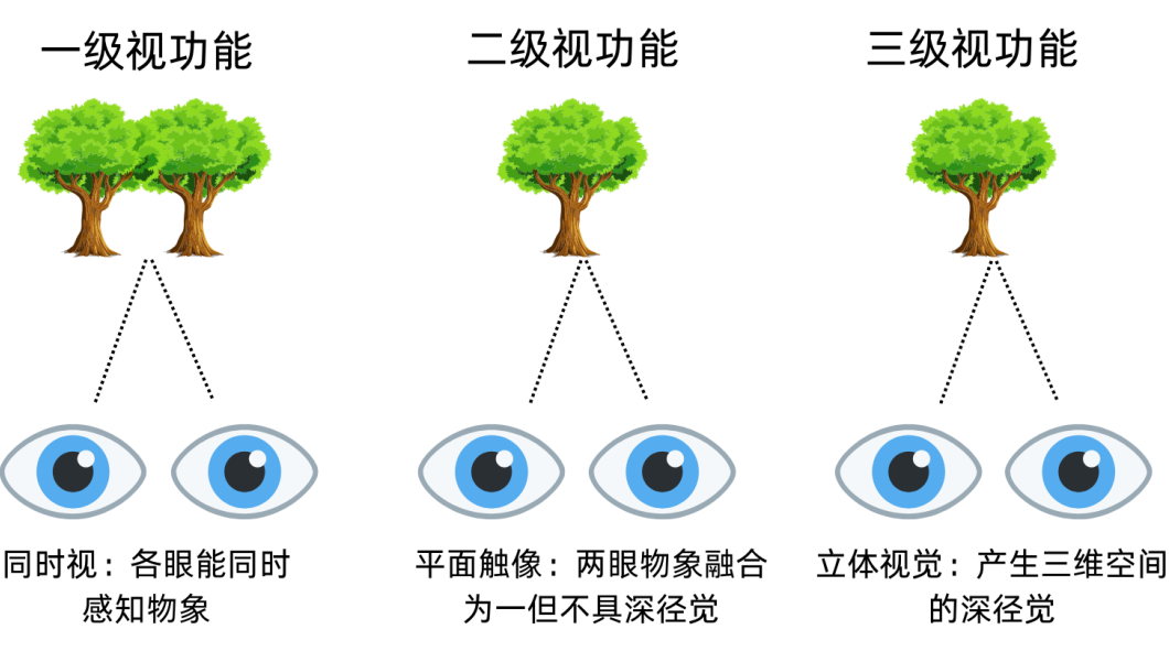 同时视(一级),融合视(二级),立体视(三级)