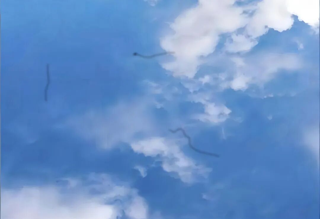 西安华厦眼科 | 眼前有黑影飘，这是咋回事？