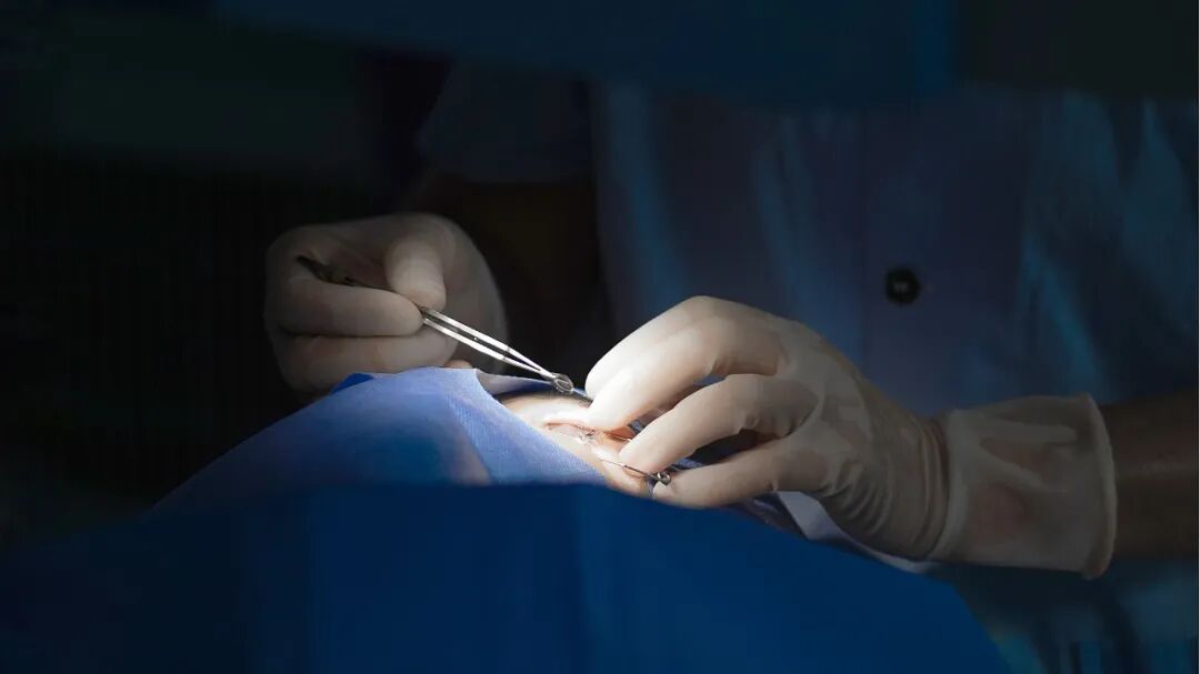 徐州复兴眼科 | 这8件事，做完全飞秒才知道！