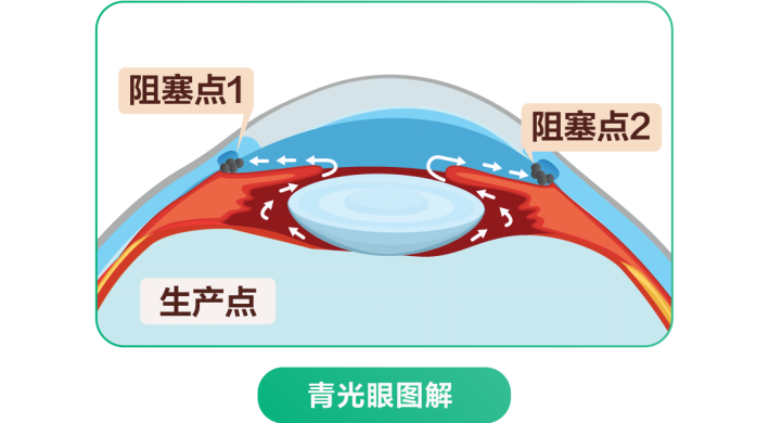 徐州复兴眼科 | 徐州又一股强&ldquo;雨&rdquo;将至，出现以下5种症状要小心！