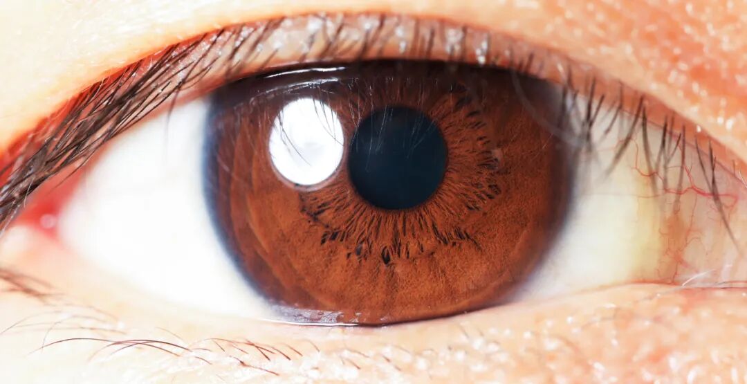 眼睛