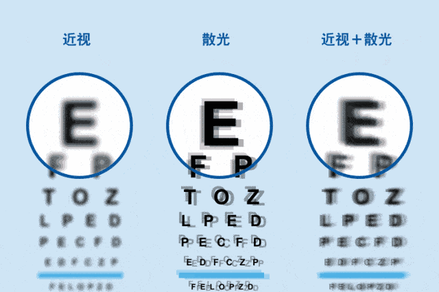 徐州复兴眼科 | 晚上开车像看&ldquo;烟花秀&rdquo;？散光可能比近视更影响你的生活